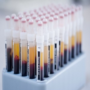Serum Test Tubes (MOQ: 100,000 Pcs Assorted Size)